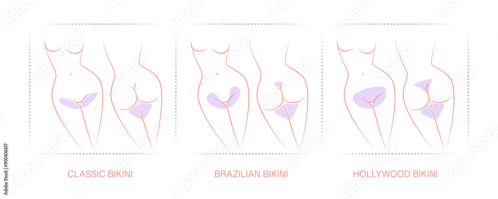 Diagram with designated areas for hair removal. Borders for hair removal: Classic bikini, Brazilian bikini, Hollywood bikini. Female epilation, depilation for girls. Diagram with designated areas for hair removal. Borders for hair removal: Classic bikini, Brazilian bikini, Hollywood bikini. Female epilation, depilation for girls.