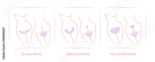 Diagram with designated areas for hair removal. Borders for hair removal: Classic bikini, Brazilian bikini, Hollywood bikini. Female epilation, depilation for girls.