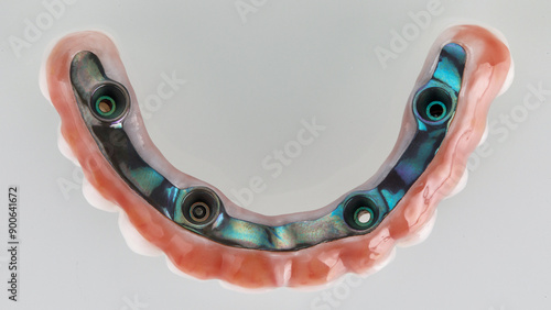 titanium beam in a zircon prosthesis with gum, top view on a white background