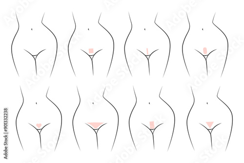Bikini area hair removal in different styles. Haircuts zone bikini, wax depilation styles.