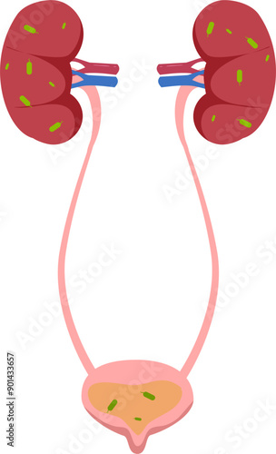 Kidney disease Illustration