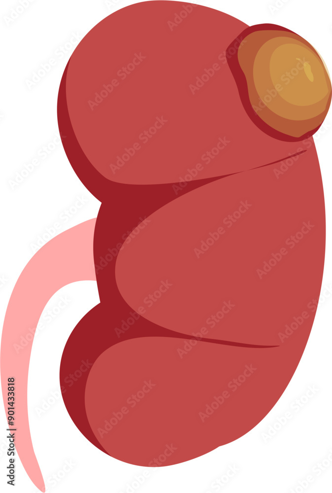 Kidney disease Illustration Kidney disease Illustration