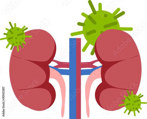 Kidney disease Illustration