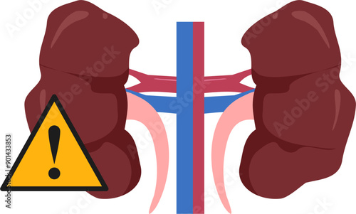 Kidney disease Illustration