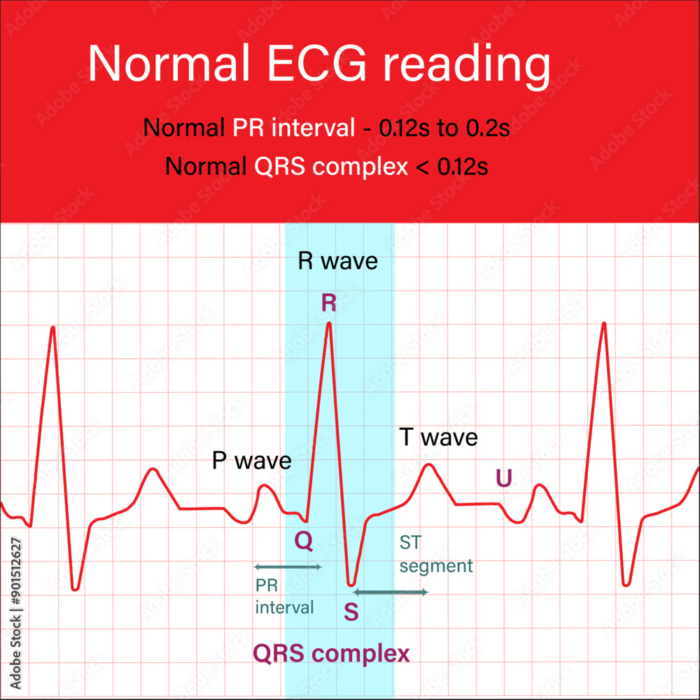 Normal ECG reading Cardiograme PR interval QRS compex Normal ECG reading Cardiograme PR interval QRS compex
