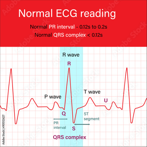Normal ECG reading Cardiograme PR interval QRS compex