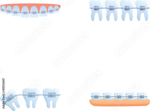 Bite correction icons set cartoon vector. Orthodontic brace system on teeth. Orthodontic treatment