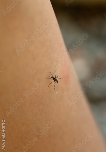 Tiger mosquito bites a man's leg. Defocused photo