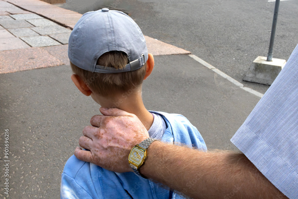 © Алла Чеснокова - Father's hand on his son's shoulder. Walking and socializing with child. Desire to support, to guide. Child-parent relationship.Life with vitiligo.