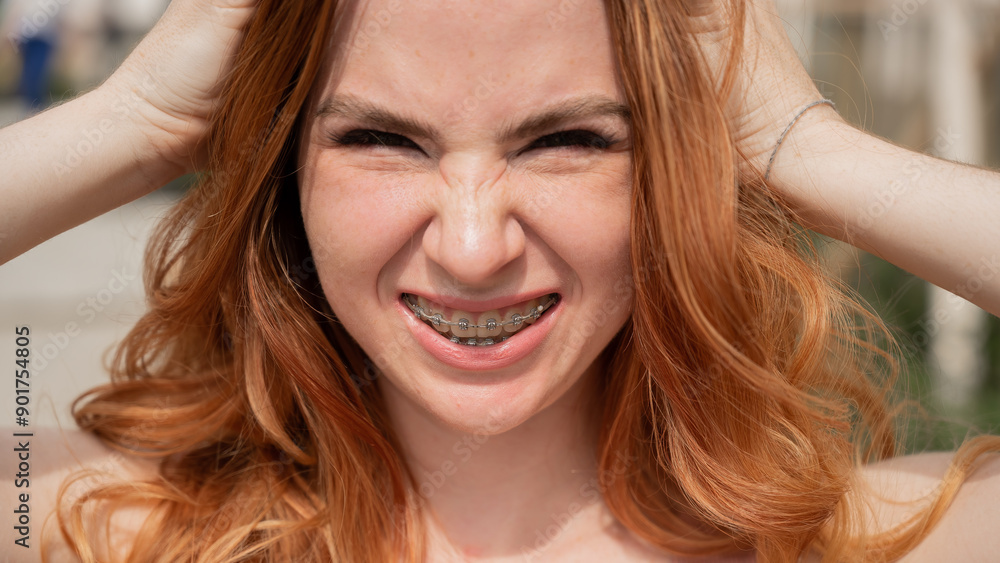 Close-up portrait of a young red-haired woman with braces on her teeth. Girl makes faces at the camera outdoors. Close-up portrait of a young red-haired woman with braces on her teeth. Girl makes faces at the camera outdoors.