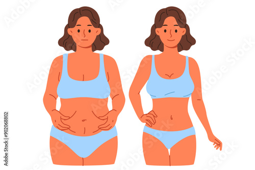 Thinner woman compares result before and after using new diet or joining fitness club with personal trainer. Thinner girl in swimsuit shows off excellent effect of liposuction done by surgeon