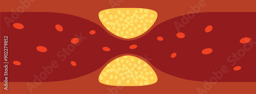 Icon cholesterol thrombosis artery microvascular disease. Arteriosclerosis blood vector atherosclerosis risk