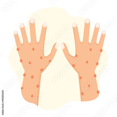 concept illustration of hands experiencing bumps, itching, flat style vector illustration.