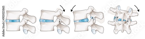 The mobility of the lumbar vertebrae. Facet joint. Medical illustration.