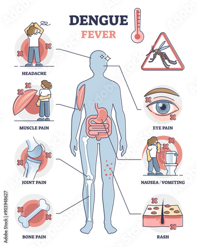 Dengue fever symptoms awareness poster, educational illustration diagram, transparent background. Infectious mosquito disease diagnosis - skin rash, vomiting or nausea, headache.