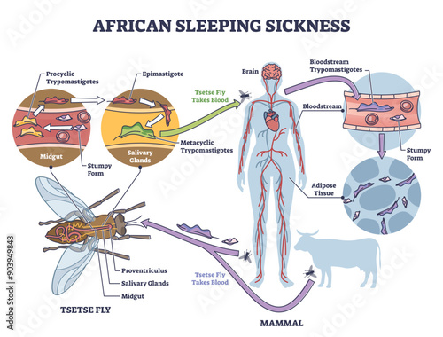African sleeping sickness or African trypanosomiasis illustration diagram, transparent background. Insect borne parasitic infection of humans and animals.