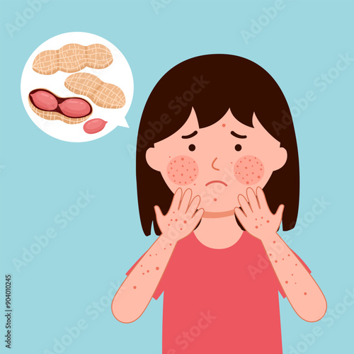 Girl child with peanut allergy symptom in flat design.