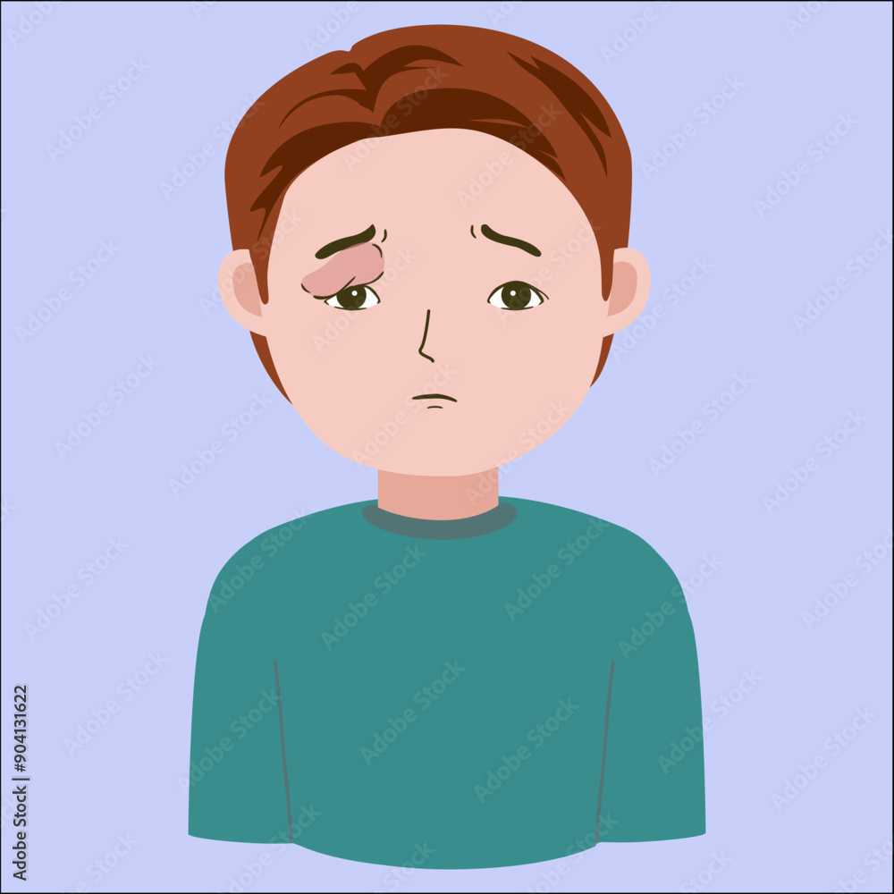 Vector illustration of young man having allergyc reaction, swollen eye, good for showing sick symptoms, isolated on blue background Vector illustration of young man having allergyc reaction, swollen eye, good for showing sick symptoms, isolated on blue background
