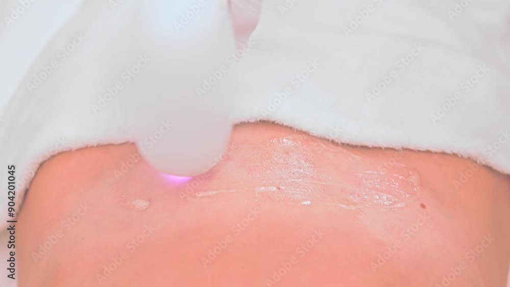 Laser hair removal in the salon. Laser hair removal in the salon.