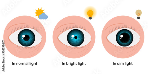 Pupil size changes by Refraction eye ophthalmology