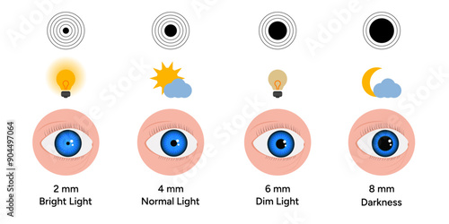 Pupil size changes by Refraction eye ophthalmology, medical illustration