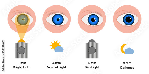 Pupil size changes by Refraction eye ophthalmology, medical illustration