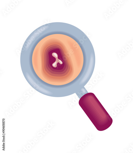 multiple myeloma bone marrow cancer