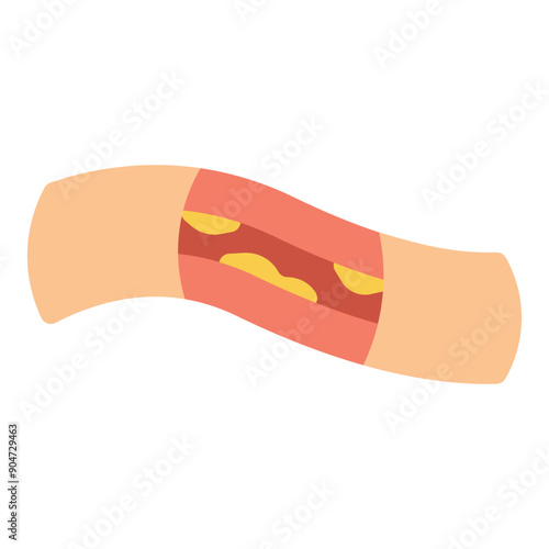 high cholesterol level flat icon