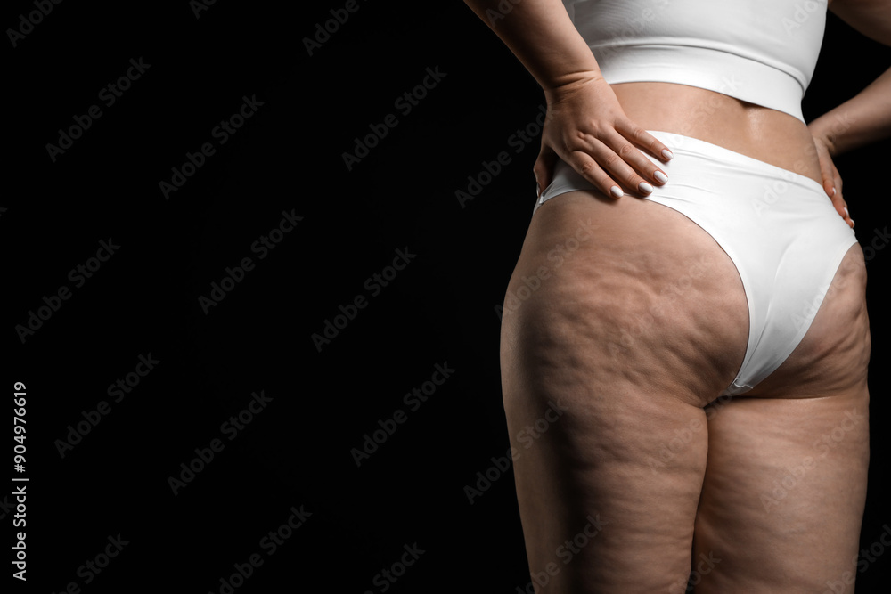 Fototapeta premium Woman with cellulite on black background, closeup. Space for text