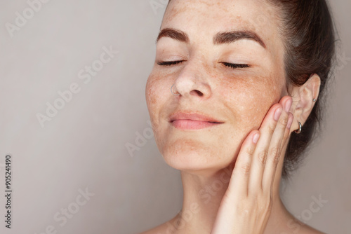 Caucasian woman's face with freckles or age spots, melasma, she loves her skin