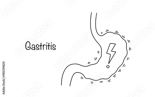 Gastritis