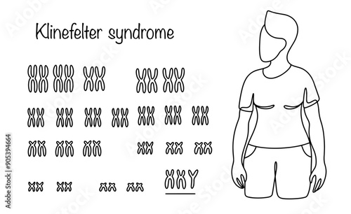 Klinefelter syndrome