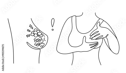 Mastitis