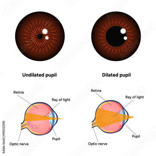 Pupil size in different lighting, Dilated pupil
and Undilated pupil  with Eye anatomy ophthalmology diagram 