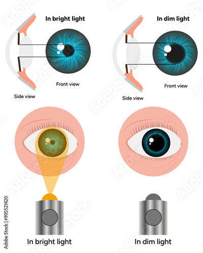 Pupil size in different lighting, Dilated pupil
and Undilated pupil  with ophthalmology diagram 