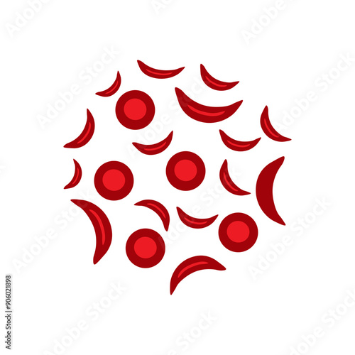 sickle blood cell and normal blood 