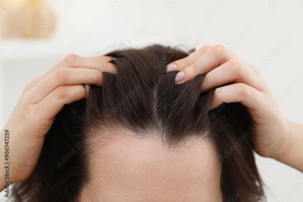 Naklejka premium Woman with hair loss problem at home, closeup