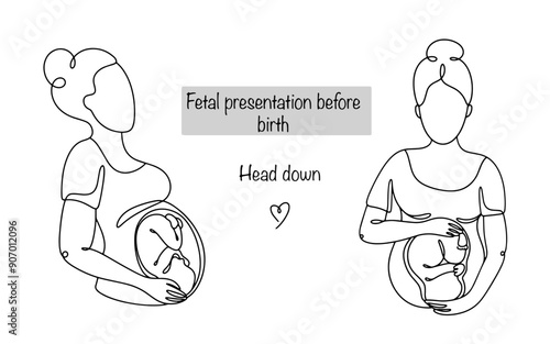 Baby's head down position