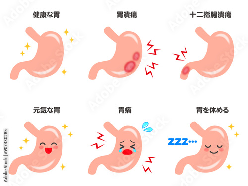 綺麗な胃腸と十二指腸潰瘍と胃潰瘍のイラスト素材セット