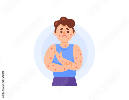 illustration of a boy suffering from chicken pox or Varicella. feeling itchy and red spots appearing on the skin. Viral infections and skin diseases. health problems. flat style character design