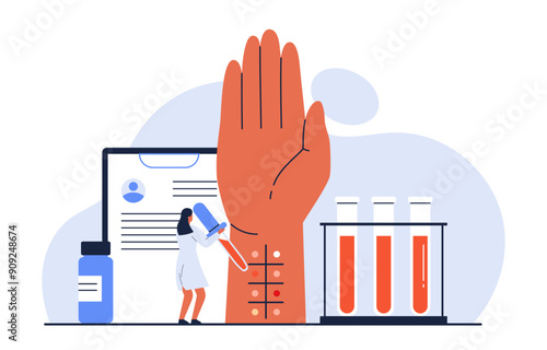 Skin allergy test concept. Tiny doctor allergist holding pipette to drop on human arm. Allergic reaction. Laboratory equipment for allergy diagnosis. Isolated vector illustration in cartoon style