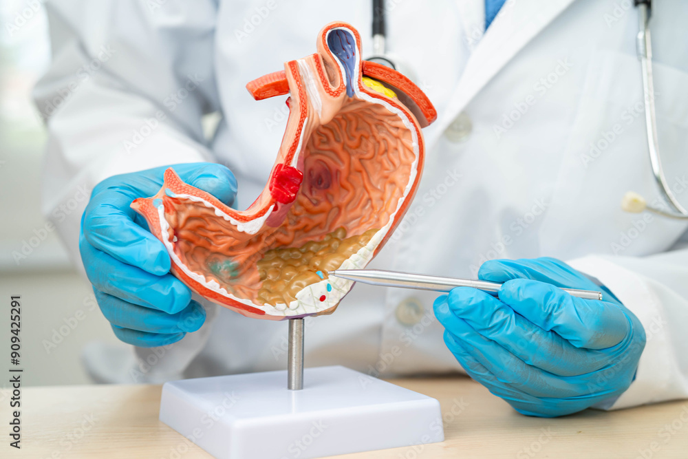 Ταπετσαρία Dyspepsia or gastric disease, doctor holding stomach anatomy model for study  diagnosis and treatment in hospital
