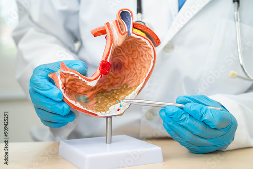 Canvastavla Dyspepsia or gastric disease, doctor holding stomach anatomy model for study  diagnosis and treatment in hospital
