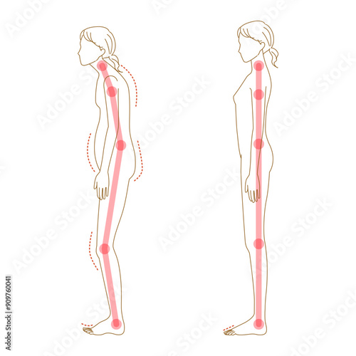 足の浮き指と正常な足裏のイラストセット（女性の全身の姿勢の崩れ）