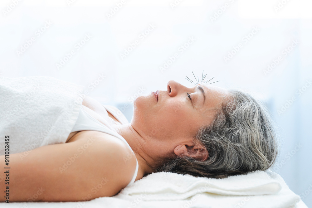 Mature woman with acupuncture needles over forehead lying on massage table Mature woman with acupuncture needles over forehead lying on massage table