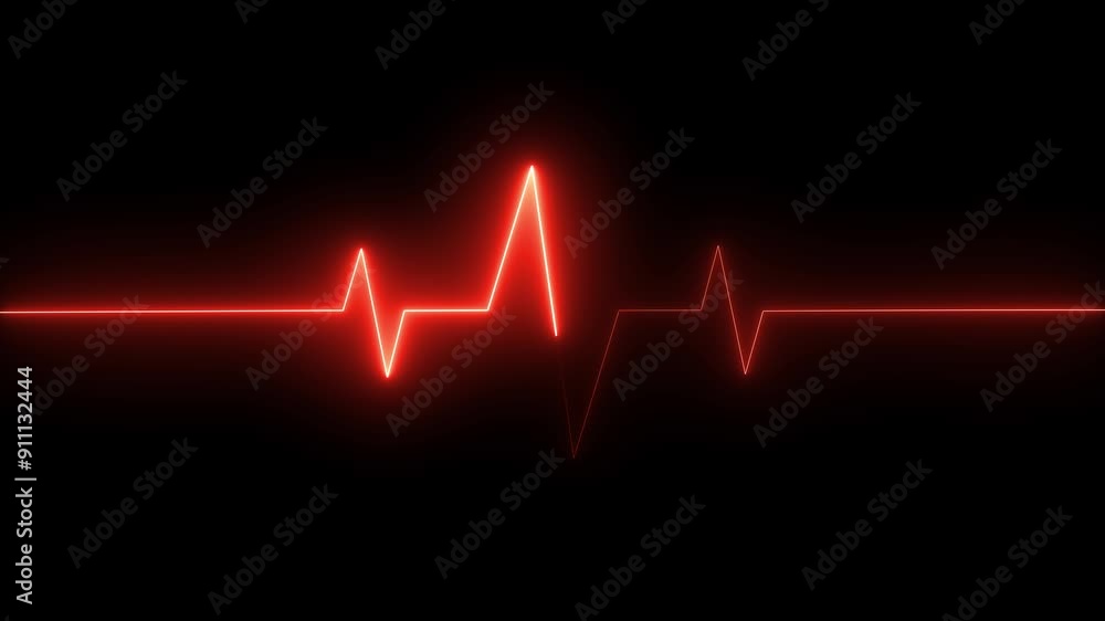 Neon Electrocardiogram Heartbeat Pulse Heart attack monitoring Medical Patient Treatment Display Background. Neon Electrocardiogram Heartbeat Pulse Heart attack monitoring Medical Patient Treatment Display Background.