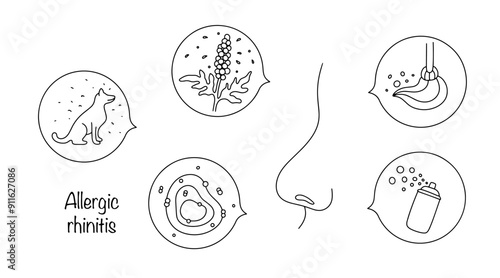 Allergic rhinitis