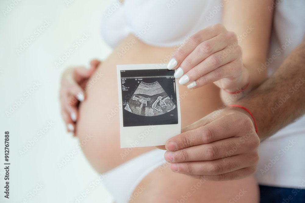 couple showing ultrasound of their baby couple showing ultrasound of their baby