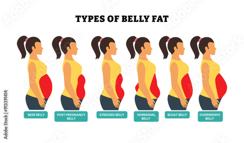 Different types of belly fat set collection, body fat healthcare poster design with detail description, labeled woman abdominal fat, stomach, legs. Unhealthy lifestyle, Weight loss diet concept.