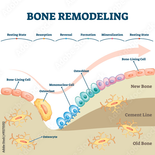 Bone remodeling process educational explanation with labeled structure scheme illustration, transparent background. Skeleton growth closeup and formation stages with osteocyte, osteoclast.